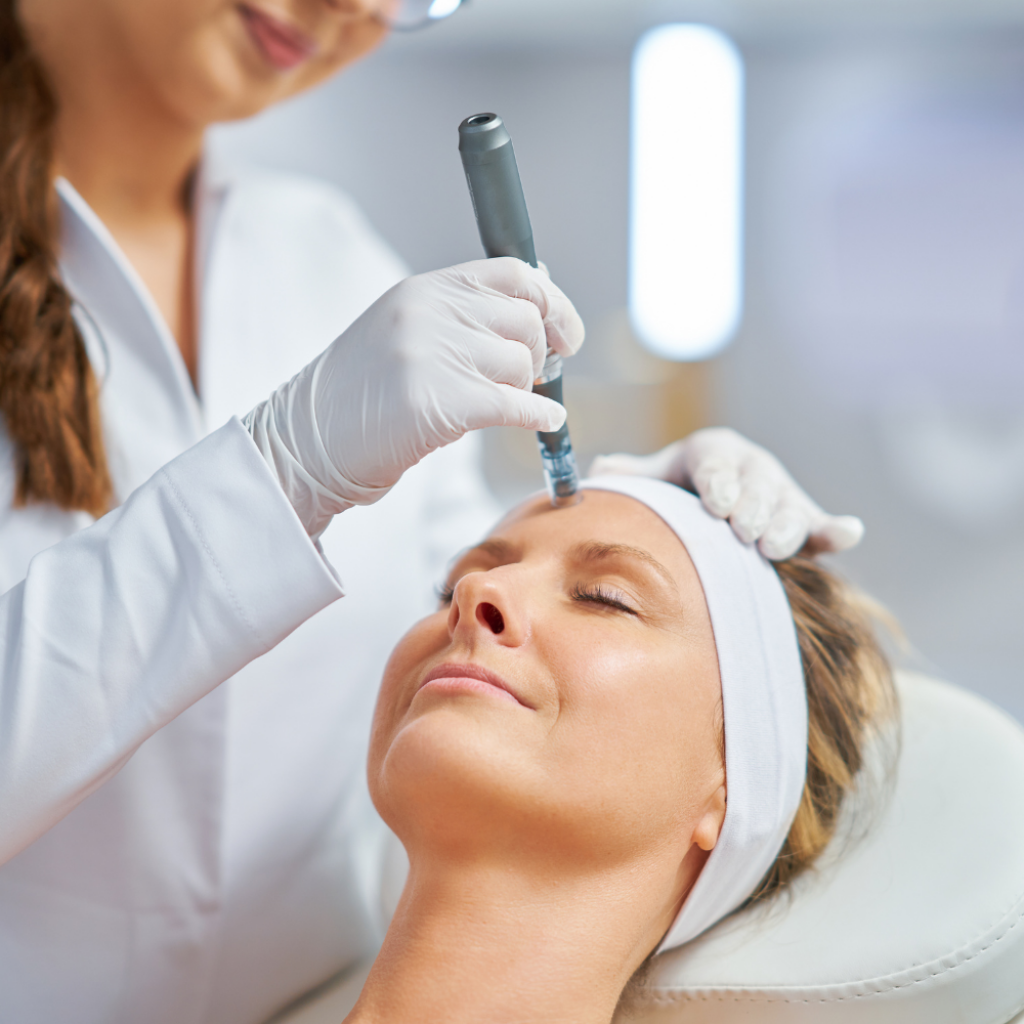 Microneedling-Behandlung auf der Stirn in der Beautylounge Basel – Dermapen regt Kollagenbildung an und verbessert die Hautstruktur.