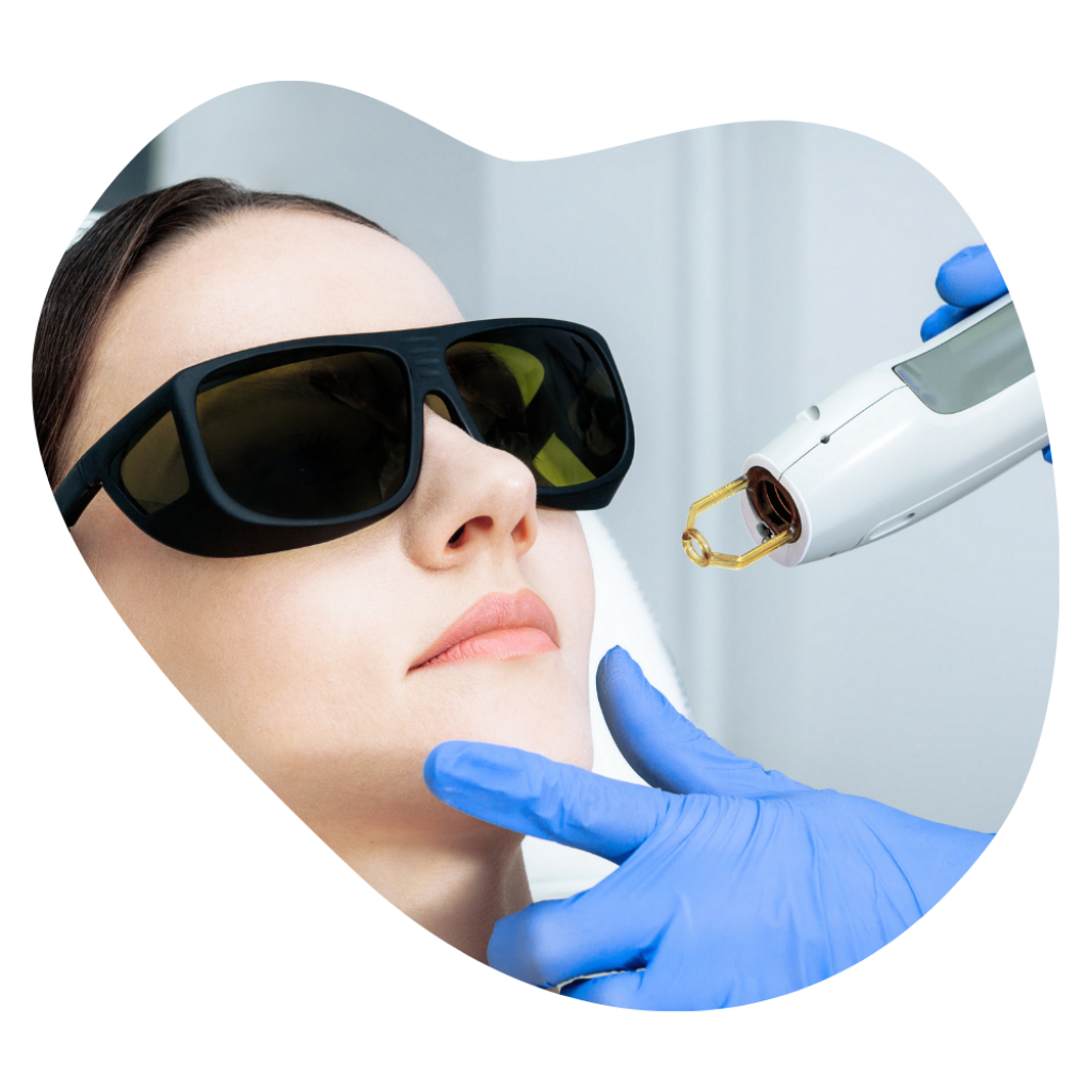 Ausgebildete Kosmetikerin in Basel f&uuml;hrt professionelle IPL-Therapie gegen Pigmentflecken durch.