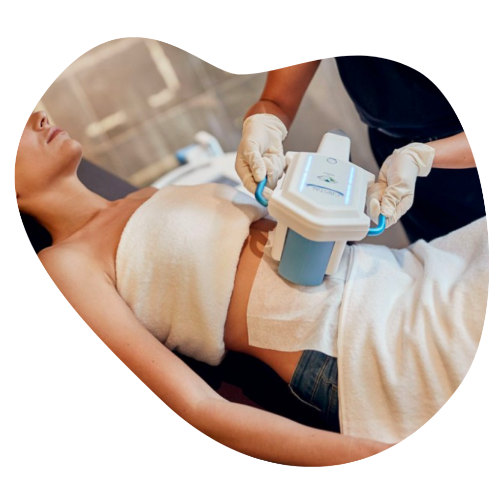 Kryolipolyse Behandlung am Bauch einer Kundin in der Beautylounge Basel.