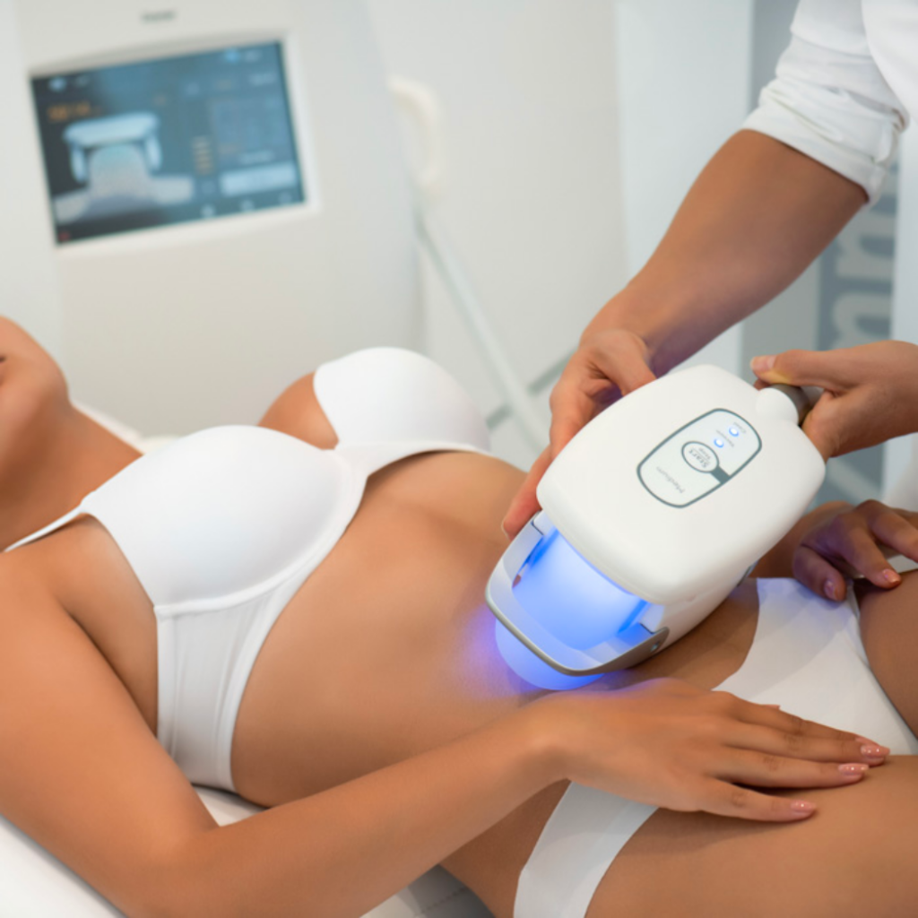 Diodenlaser wird an der Bikinizone angesetzt, dauerhafte Haarentfernung in der Beautylounge.