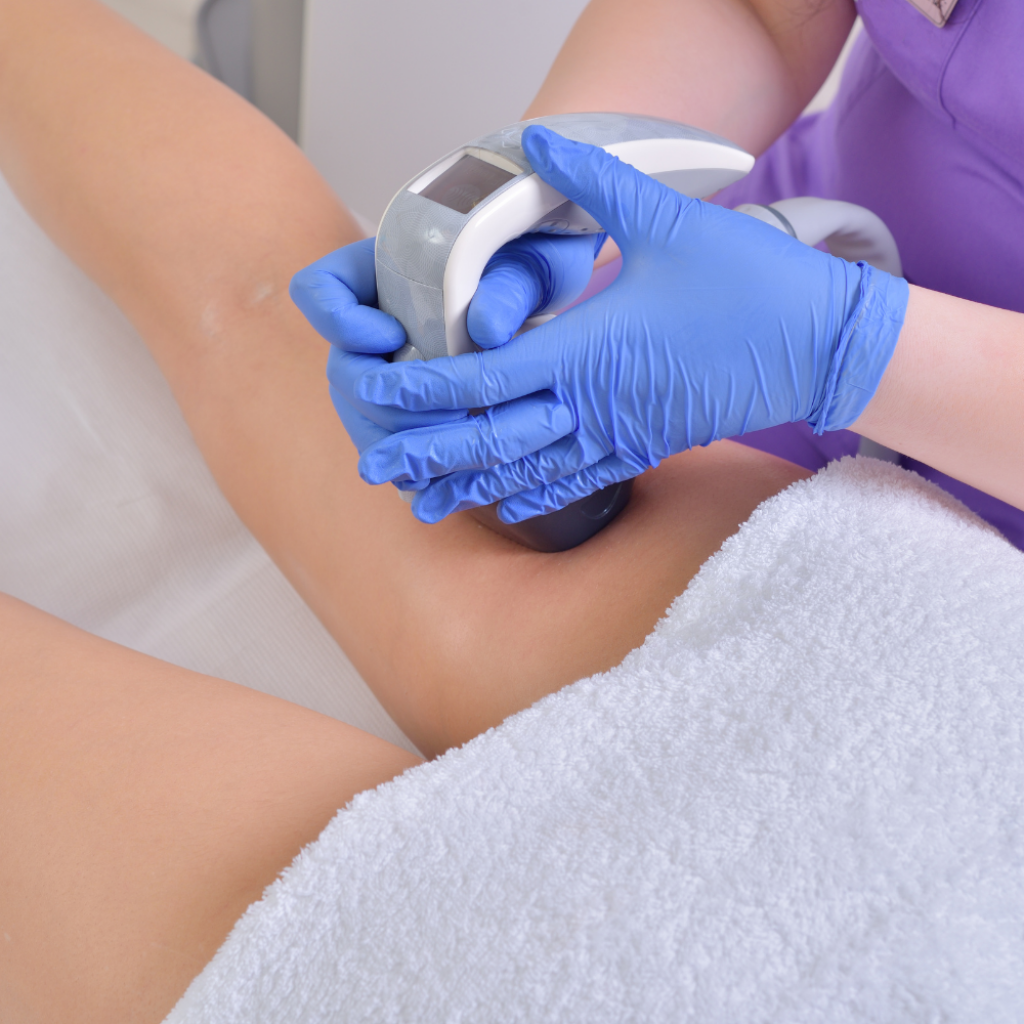 Kosmetikerin f&uuml;hrt Cellu Velashape Behandlung am Oberschenkel durch.