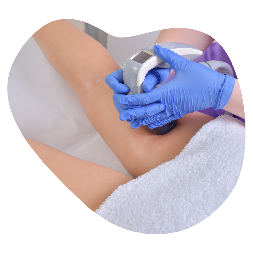 Kosmetikerin f&uuml;hrt Cellu Velashape Behandlung am Oberschenkel durch.