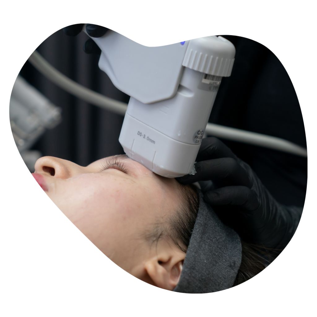 Ausgebildete Kosmetikerin f&uuml;hrt wirksame HIFU-Therapie im Gesicht durch, Beautylounge Basel f&uuml;r perfektes Anti-Aging.