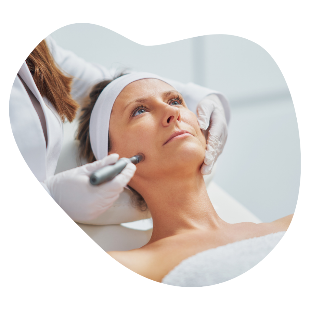 Kosmetikerin f&uuml;hrt Microneedling auf den Wangen durch, f&uuml;r ein ebenm&auml;ssiges Hautbild und die Behandlung von Aknenarben.