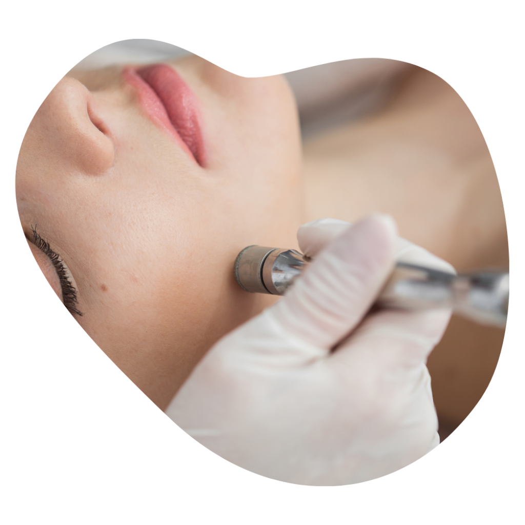 Nahaufnahme eines Handst&uuml;cks w&auml;hrend der Diamant Hydro Microdermabrasion, sanfte Abtragung abgestorbener Hautzellen.