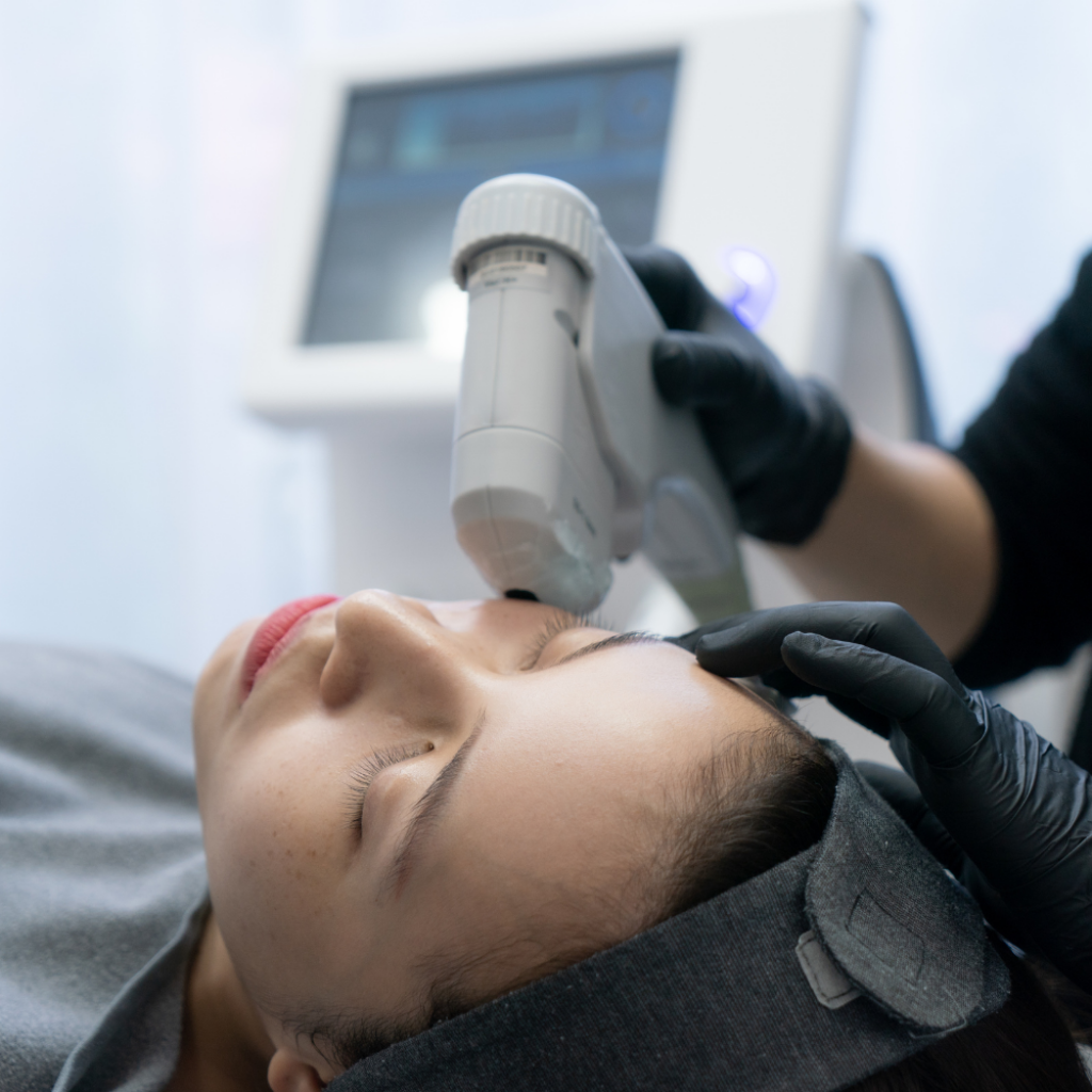 Kundin w&auml;hrend professioneller HIFU-Behandlung in der Beautylounge Basel, effiziente Hautstraffung ohne OP.