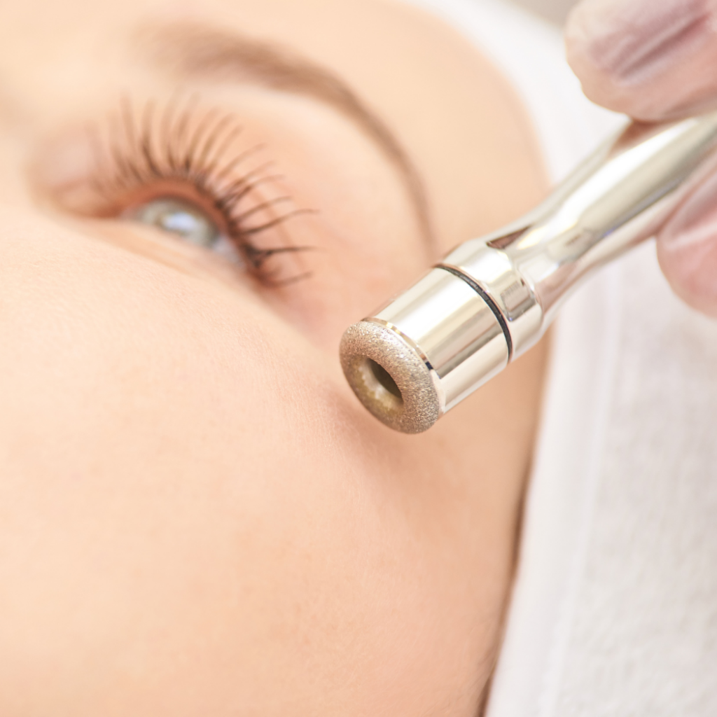 Nahaufnahme Hydro Microdermabrasion, sanfte Hautabtragung mit Diamant-Handst&uuml;ck.