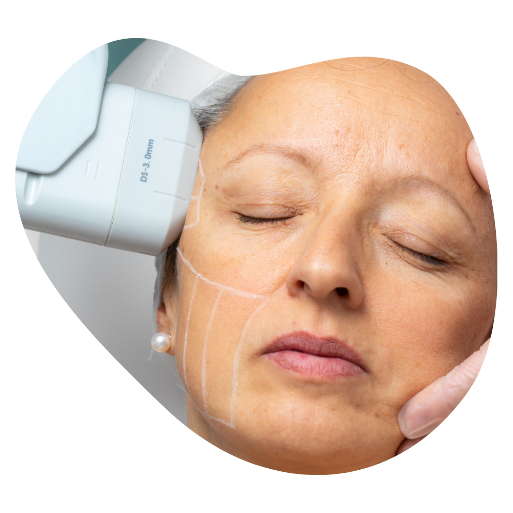 Innovative Ger&auml;tebehandlung in der Beautylounge Basel, f&uuml;r straffere Haut und frischen Glow.