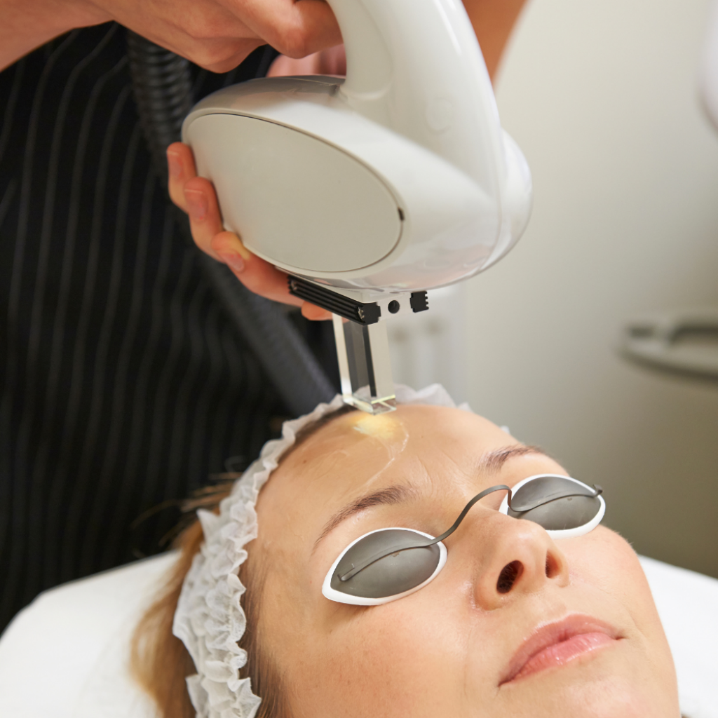 Kundin bei professioneller IPL-Behandlung durch ausgebildete Kosmetikerin in der BeautyLounge Basel.