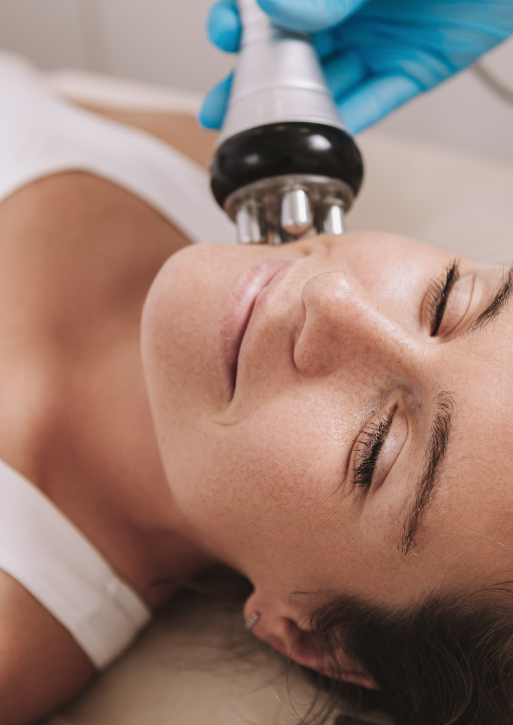 Radiofrequenz Behandlung im Gesicht einer Kundin in der Beautylounge Basel.