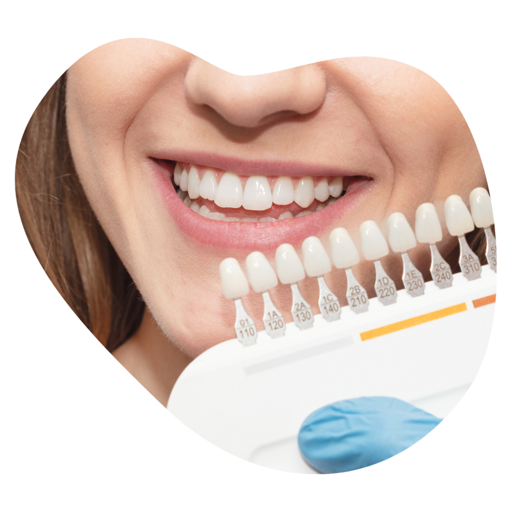 Kundin beim Teeth Whitening in Basel, ausgebildete Kosmetikerin zeigt mit Farbskala die m&ouml;glichen Zahnaufhellungsstufen f&uuml;r ein perfektes L&auml;cheln.