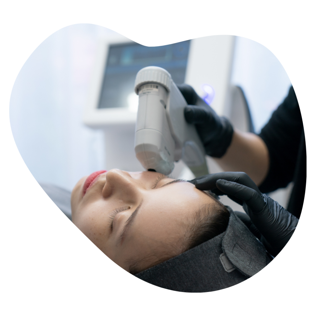 Effiziente HIFU-Behandlung am Hals in der Beautylounge Basel, professionelle Ultraschalltechnologie f&uuml;r straffe Haut.